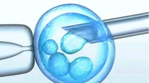 试管婴儿助孕中心 | 东莞试管供卵机构 | 东莞供卵试管中心