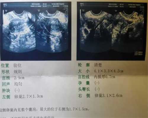 南京试管婴儿咨询中心：鼓楼地区专业试管服务